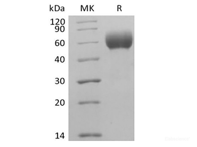 Recombinant Human Signal-Regulatory Protein  alpha-1/SIRPA/CD172a (C-6His-Avi) Biotinylated