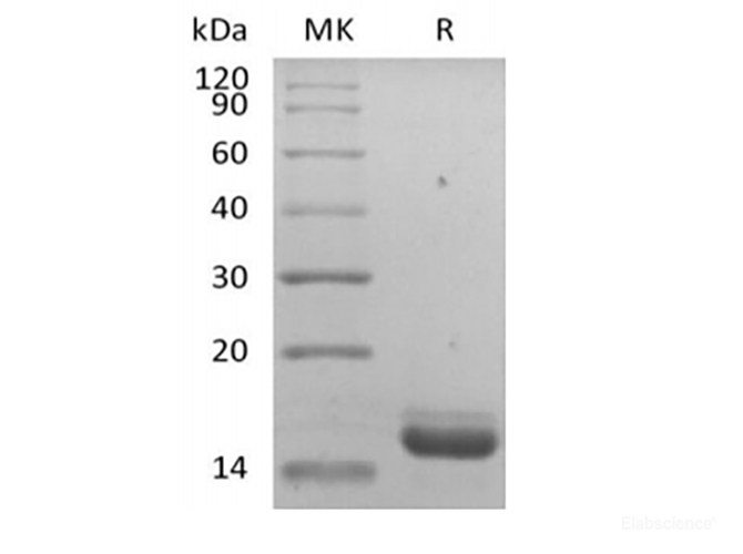 Recombinant Human IL-36 Receptor Antagonist Protein/IL-36RN/IL-1F5