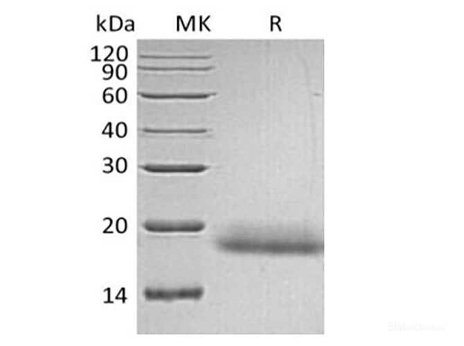 Recombinant Human CD99/MIC2 (C-6His)