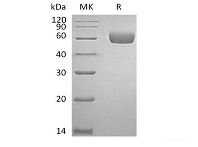 Recombinant Human Serpin A7/TBG (C-6His)