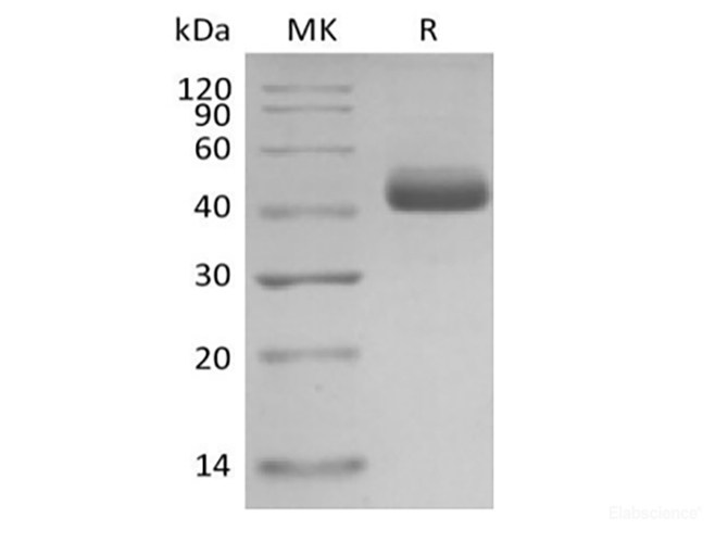 Recombinant Human Interleukin-5/IL-5 (C-mFc)