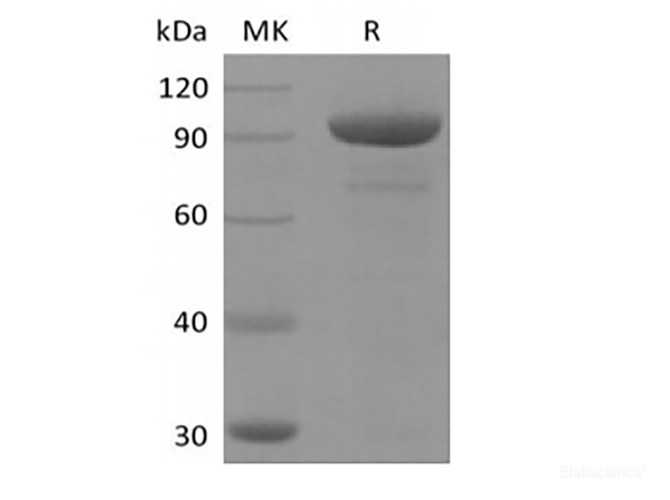 Recombinant Human 5'-Nucleotidase/5'-NT/CD73  (AAH65937.1, C-Fc)