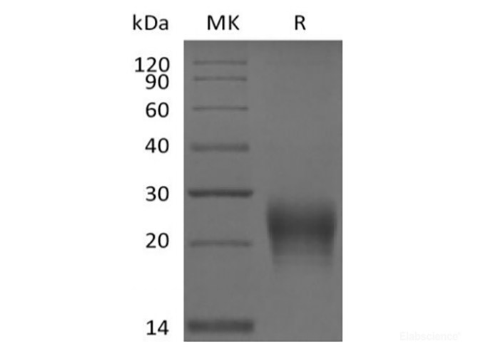 Recombinant Human Fas Ligand / TNFSF6 (N-6His)