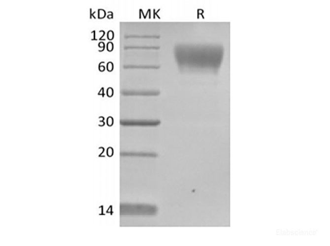 Recombinant Human TPBG/5T4 (C-Avi-6His) Biotinylated
