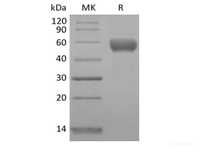 Recombinant Human CD79B/B29 (C-Fc)