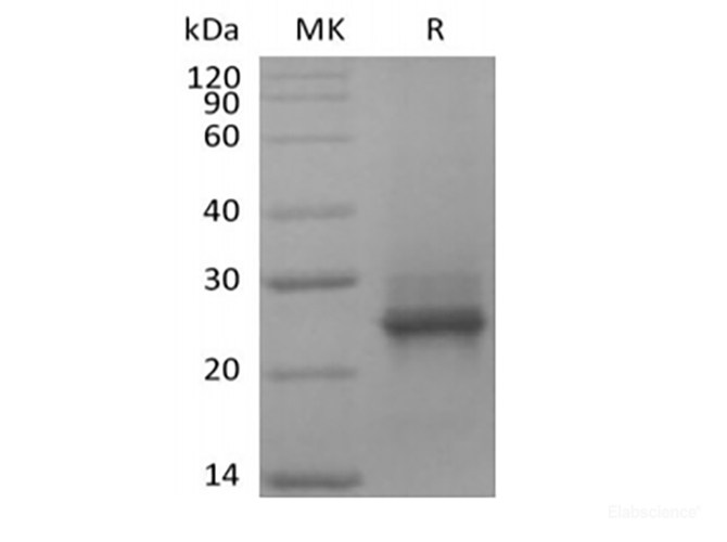 Recombinant Human KRAS(G12C, N-6His)