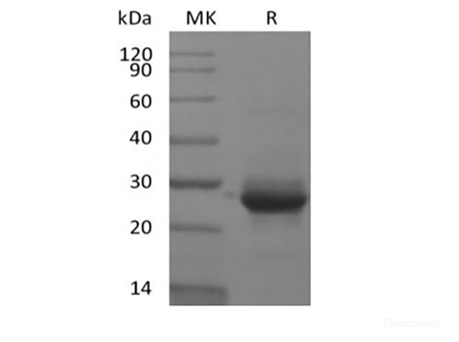 Recombinant Human KRAS(G12V, N-6His)