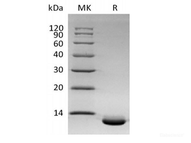Recombinant Human C-X-C Motif Chemokine 6/CXCL6 (C-6His)