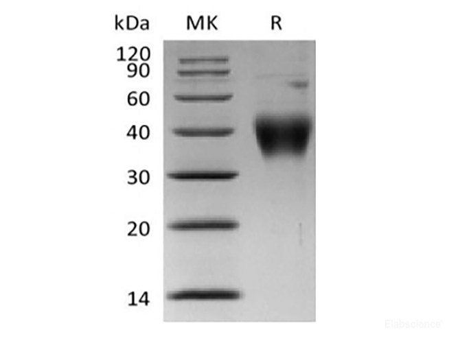 Recombinant Human Thymic Stromal Lymphopoietin Receptor/TSP R/CRLF2 (C-6His)