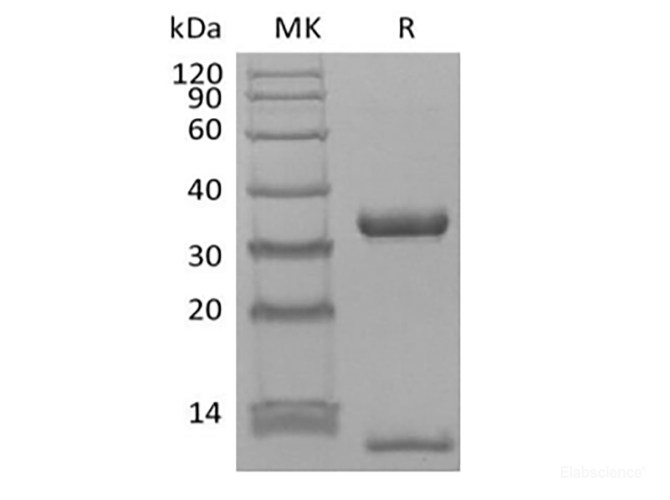 Recombinant Human FcRn & B2M Heterodimer (C-6His-Avi) Biotinylated