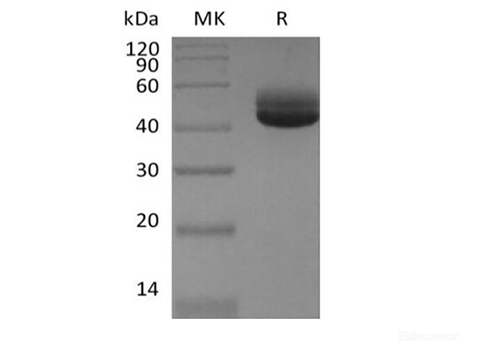 Recombinant Human IL-4 (C-Fc)