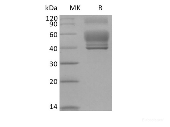 Recombinant Human Interleukin-13/IL-13 (C-Fc)