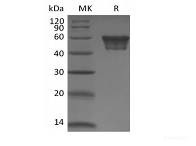 Recombinant Human CD82 (N-Fc)