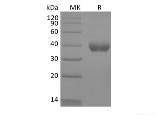 Recombinant Human IL-2 Receptor Subunit Beta/IL-2RB/CD122 (C-6His-Avi) Biotinylated