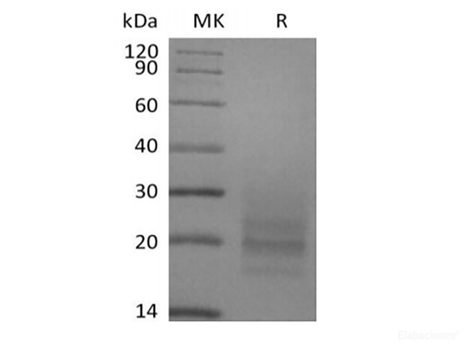 Recombinant Human CD3D&CD3E Heterodimer (C-6His)