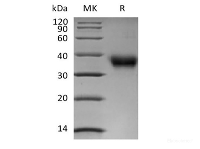 Recombinant Human Folate Receptor  alpha/FOLR1 (C-6His-Avi) Biotinylated
