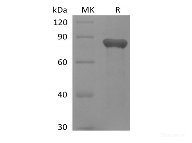 Recombinant Human GAS6 (C-6His)