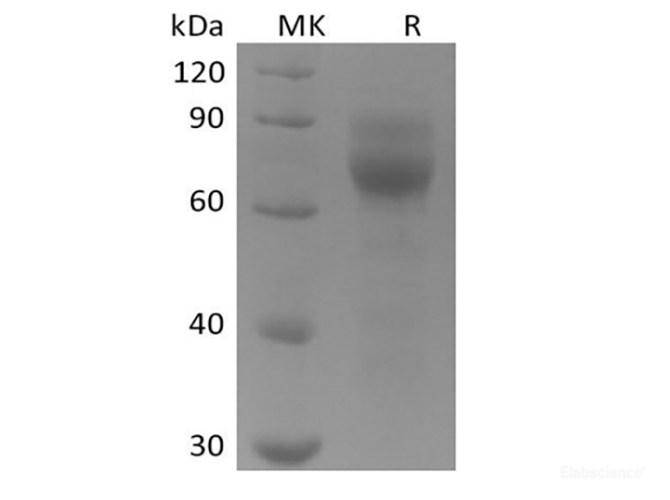 Recombinant Human Tyrosine-protein kinase receptor UFO/AXL oncogene/UFO (C-6His)