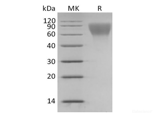 Recombinant Human Hematopoietic progenitor cell antigen CD34/CD34 (C-6His)