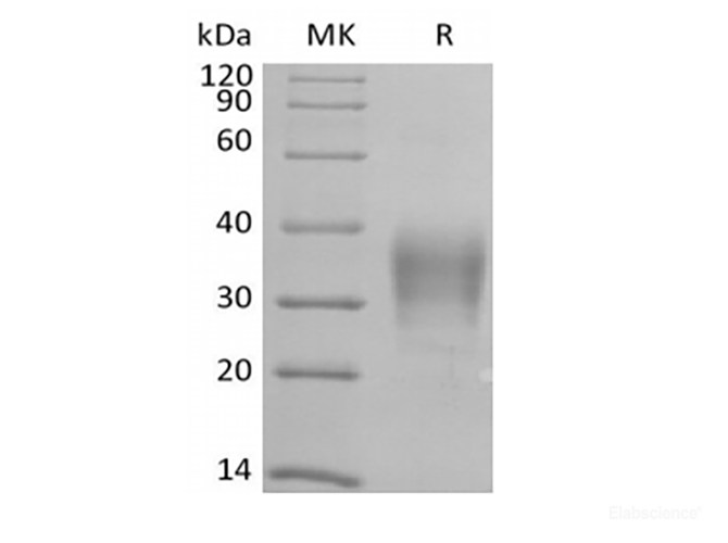Recombinant Human CD79B/B29 (C-6His-Avi) Biotinylated