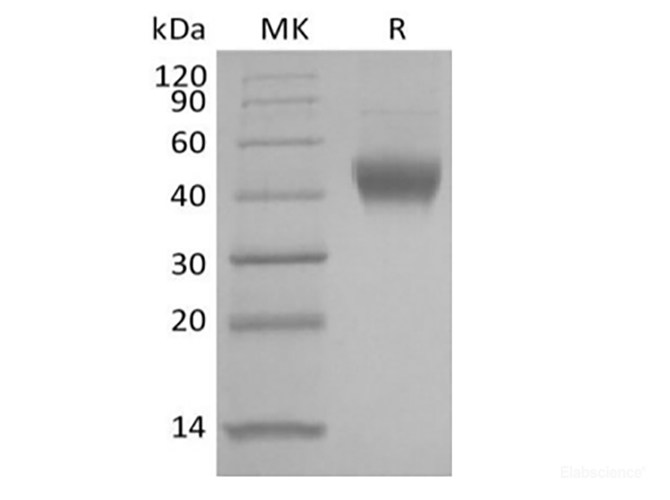 Recombinant Human IL-7 Receptor Subunit  alpha/IL-7RA/CD127 (C-6His)
