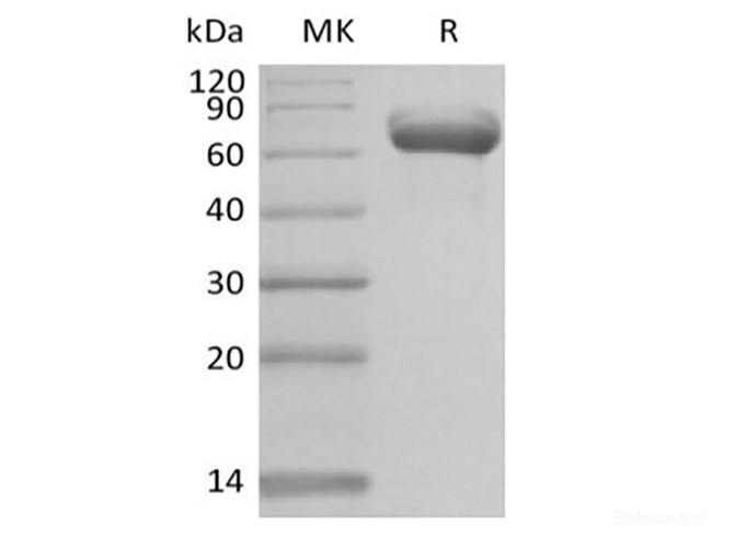 Recombinant Human Butyrophilin Subfamily 1 Member A1/BTN1A1 (C-Fc)