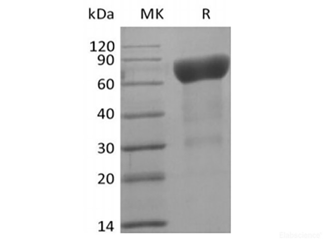 Recombinant Human IL-6 Receptor Subunit  alpha/IL-6RA/CD126 (C-Avi-6His) Biotinylated