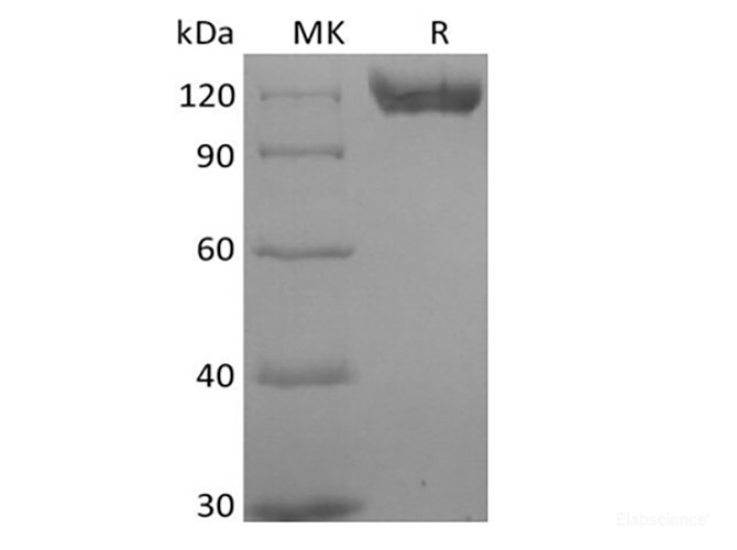Recombinant Human B-cell Receptor CD22/Siglec-2/CD22 (C-6His) Biotinylated