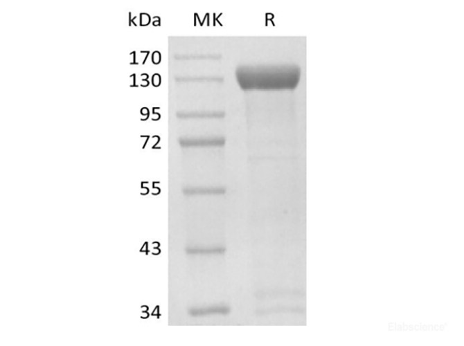 Recombinant Human Receptor Tyrosine-Protein Kinase ErbB-2/HER2 (C-Fc-Avi)  Biotinylated