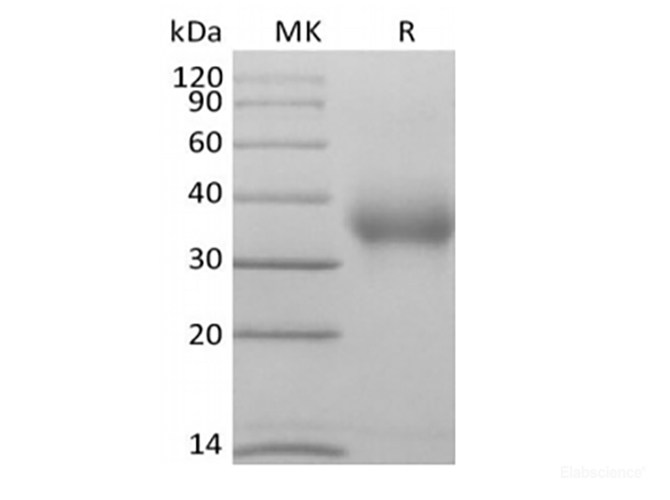 Human CD47/IAP/OA3  (C-Avi-6His) Biotinylated