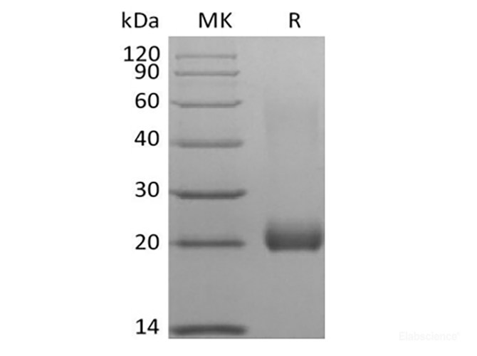 Recombinant Human Leukocyte-associated Immunoglobulin-like Receptor 2/ LAIR2/CD306 (C-Avi-6His) Biotinylated