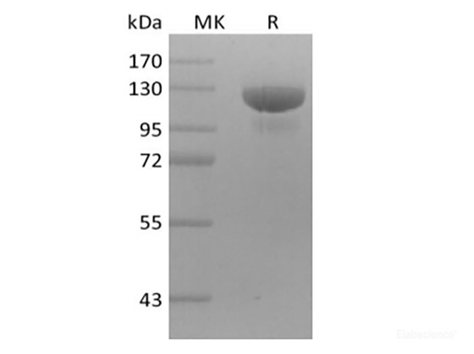 Recombinant Human Receptor Tyrosine-Protein Kinase ErbB-3/HER3 (C-mFc)