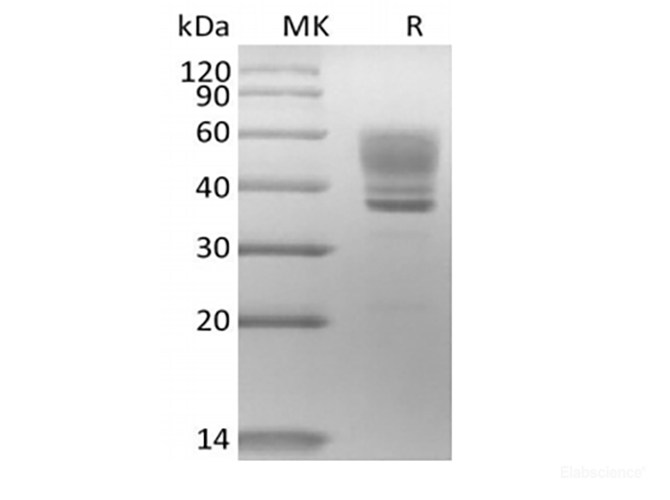 Recombinant Human Interleukin-13/IL-13 (C-mFc)