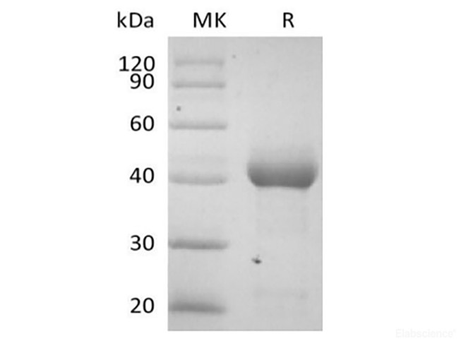 Recombinant Human Activin RIA/ALK-2 (C-Fc)
