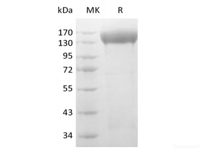 Human VEGF Receptor 2/VEGF R2/FLK-1/KDR (C-6His-Avi) Biotinylated