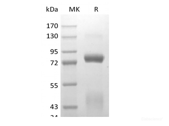 Recombinant Human Hepatocyte Growth Factor Receptor/HGF R/cMet (C-6His-Avi) Biotinylated
