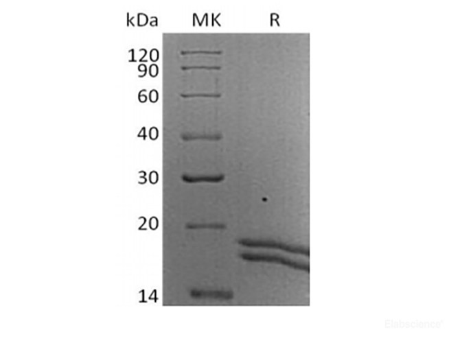 Recombinant Human Interleukin-2/IL-2 (C-6His-Avi) Biotinylated