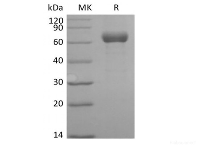Recombinant Human Angiopoietin-related Protein 3/ANGPTL3 (C-Fc)