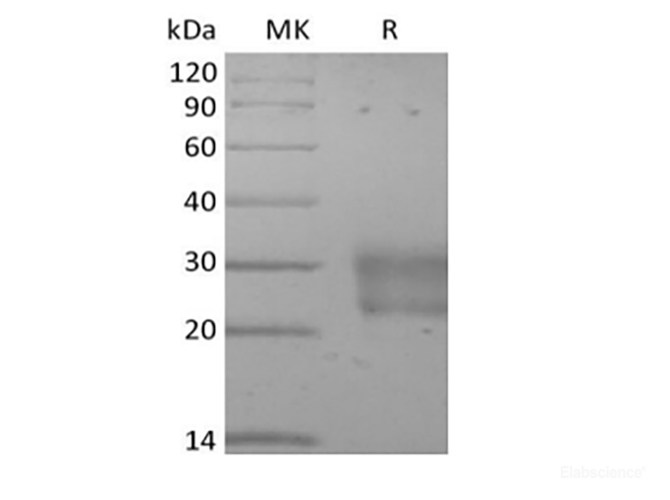 Recombinant Human Frizzled-8 (C-6His)
