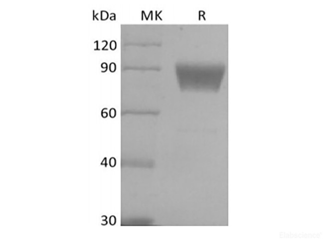 Recombinant Human B7 Homolog 4/B7-H4/VTCN1 (C-Fc-Avi) Biotinylated