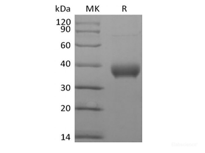 Recombinant Human Butyrophilin Subfamily 1 Member A1/BTN1A1 (C-6His-Avi) Biotinylated