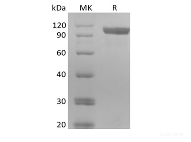 Recombinant Human Receptor Tyrosine-Protein Kinase ErbB-3/HER3 (C-6His-Avi) Biotinylated