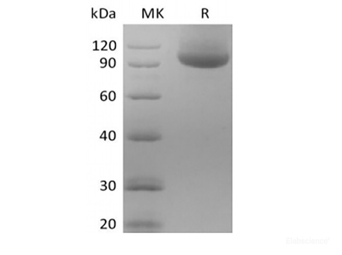 Recombinant Human Neuropilin-1/NRP1 (C-Avi-6His) Biotinylated