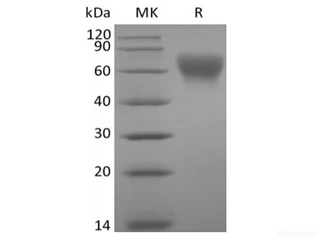 Recombinant Human B7-2/CD86 (C-Avi-6His) Biotinylated