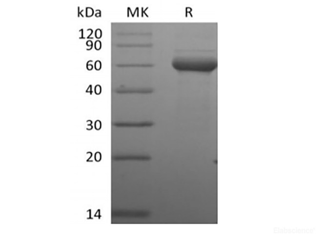 Recombinant Human Butyrophilin Subfamily 3 Member A1/BTN3A1 (C-Fc-Avi) Biotinylated