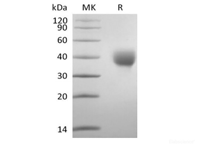 Recombinant Human  Leukocyte Ig-Like Receptor A5/LILRA5/CD85f (C-6His-Avi) Biotinylated