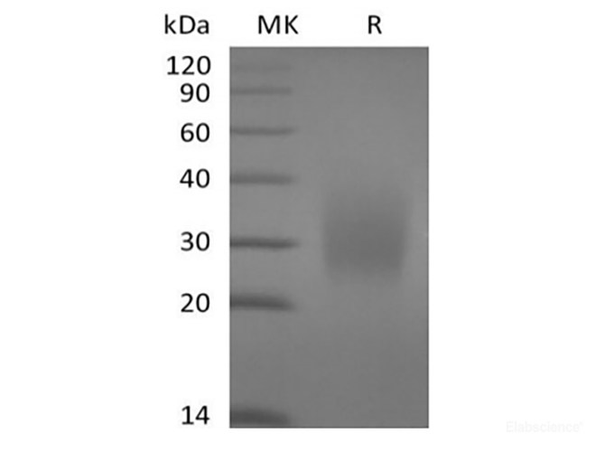 Recombinant Human CD79A(C-6His)