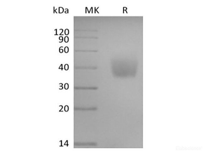Recombinant Human SLAM Family Member 6/SLAMF6/CD352/NTB-A (C-6His-Avi) Biotinylated