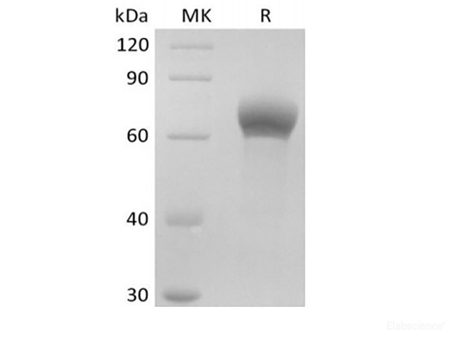 Recombinant Human Dickkopf-Related Protein 1/DKK-1 (C-Fc)