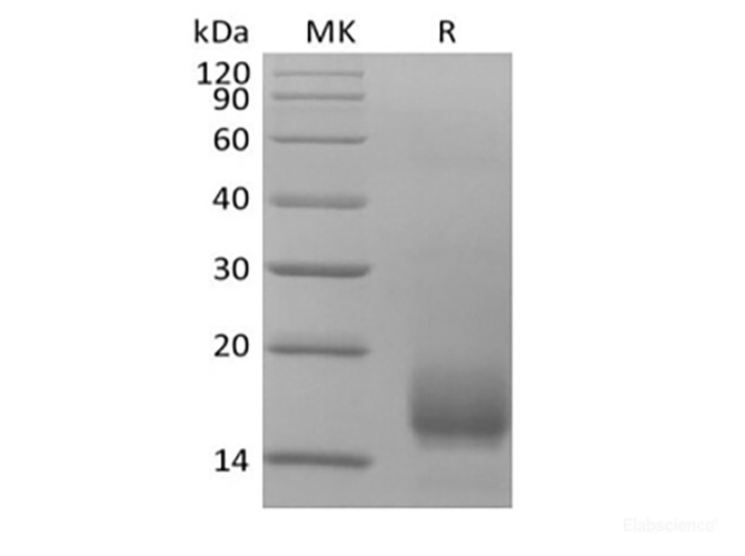 Recombinant Human CD59 (C-6His)